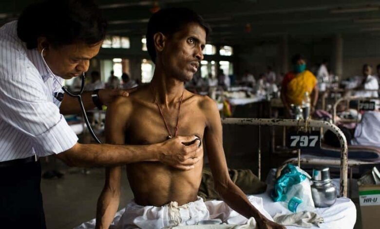 دراسة-:-العلاج-الوقائي-يمكن-أن-ينقذ-حياة-الآلاف-من-مرض-السل